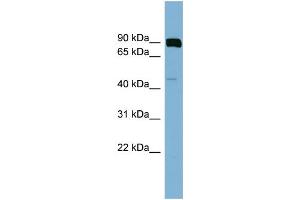 WB Suggested Anti-PSEN1  Antibody Titration: 0. (Presenilin 1 抗体  (N-Term))