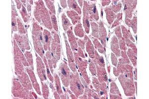 Anti-UNG antibody IHC of human heart.