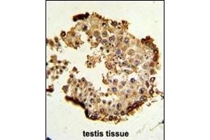 Immunohistochemistry (Paraffin-embedded Sections) (IHC (p)) image for anti-Heat Shock Protein 90kDa alpha (Cytosolic), Class B Member 1 (HSP90AB1) (AA 438-465) antibody (ABIN392346)