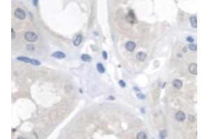 Immunohistochemistry (IHC) image for anti-Fumarate Hydratase (FH) (AA 45-188) antibody (ABIN7444424)