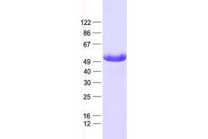 Western Blotting (WB) image for Growth Factor Independent 1 (GFI1) protein (His tag) (ABIN2735930)