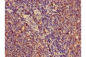 Immunohistochemistry of paraffin-embedded human lymph node tissue using ABIN7155625 at dilution of 1:100 (HLA-C 抗体  (AA 25-308))
