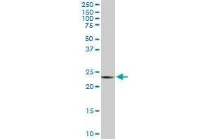 Western Blotting (WB) image for anti-Progesterone Receptor Membrane Component 2 (PGRMC2) (AA 124-223) antibody (ABIN564535)