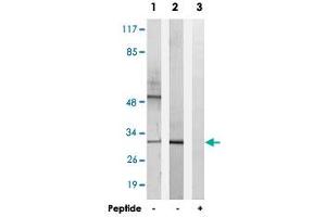 Western blot analysis of extracts from K-562 cells (Lane 1) and RAW 264. (HOXD10 抗体)