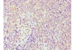Immunohistochemistry of paraffin-embedded human tonsil tissue using ABIN7174019 at dilution of 1:100 (FES 抗体  (AA 120-420))