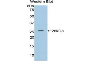 Western Blotting (WB) image for anti-Coagulation Factor VIII-Associated 1 (F8A1) (AA 171-375) antibody (ABIN1858769) (Coagulation Factor VIII-Associated 1 (F8A1) (AA 171-375) 抗体)