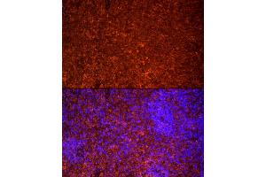 Immunofluorescence analysis of rat spleen cells using TLR7 Rabbit pAb (ABIN3021246, ABIN3021247, ABIN3021248 and ABIN6214083) at dilution of 1:25 (40x lens). (TLR7 抗体  (AA 30-230))