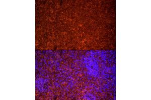 Immunofluorescence analysis of rat spleen cells using TLR7 Rabbit pAb (ABIN3021246, ABIN3021247, ABIN3021248 and ABIN6214083) at dilution of 1:25 (40x lens).