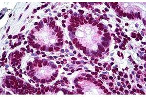 Human Small Intestine: Formalin-Fixed, Paraffin-Embedded (FFPE) (LHX1 抗体  (AA 1-101))