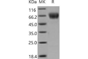 Western Blotting (WB) image for C-Type Lectin Domain Family 4, Member F (CLEC4F) protein (ABIN7194488) (CLEC4F 蛋白)