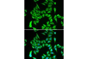 Immunofluorescence analysis of A549 cells using IREB2 antibody (ABIN6292155).