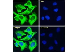 Immunofluoresence staining of fixed HeLa cells with anti-alpha 5 beta 1 Integrin antibody M200 (Volociximab).