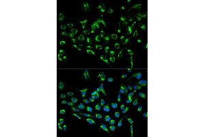 Immunofluorescence analysis of MCF7 cell using CDKN3 antibody. (CDKN3 抗体)