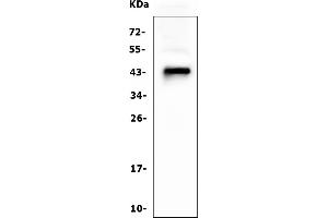 Western blot analysis of CD79A using anti ZO-1 antibody (ABIN7599837).