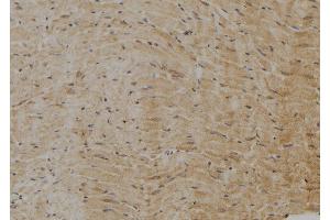 ABIN6277237 at 1/100 staining Rat heart tissue by IHC-P. (AXIN2 抗体  (N-Term))