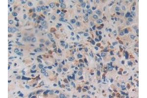 Immunohistochemistry (IHC) image for anti-Protease, serine, 2 (Trypsin 2) (PRSS2) (AA 24-241) antibody (ABIN7433747)