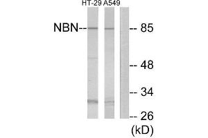 Western Blotting (WB) image for anti-Nibrin (NBN) (Internal Region) antibody (ABIN1850486) (Nibrin 抗体  (Internal Region))