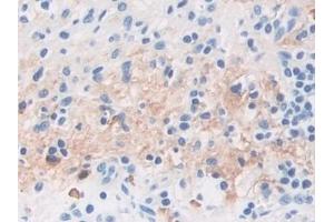 Detection of TPPP in Human Stomach Tissue using Polyclonal Antibody to Tubulin Polymerization Promoting Protein (TPPP)