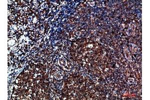Immunohistochemical analysis of paraffin-embedded human-tonsil, antibody was diluted at 1:200 (CYFIP2 抗体  (AA 1171-1220))