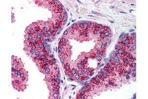 Anti-cIAP1 antibody IHC of human prostate. (BIRC2 抗体  (C-Term))