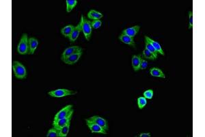 Immunofluorescence staining of HepG2 cells with ABIN7171957 at 1:400, counter-stained with DAPI. (TGFBR1 抗体  (AA 157-244))