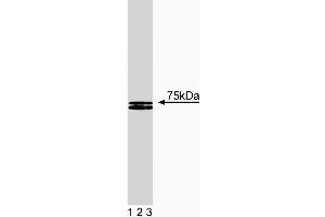 Western blot analysis of HS1 on human endothelial lysate. (HCLS1 抗体  (AA 17-190))