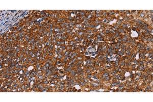Immunohistochemistry (Paraffin-embedded Sections) (IHC (p)) image for anti-Cytochrome P450, Family 2, Subfamily W, Polypeptide 1 (CYP2W1) antibody (ABIN7236726)