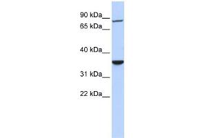 WB Suggested Anti-RNF207 Antibody Titration:  0. (RNF207 抗体  (N-Term))