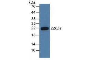 Detection of PSMb6 in Human Hela Cells using Polyclonal Antibody to Proteasome Subunit Beta Type 6 (PSMb6) (PSMB6 抗体  (AA 2-239))