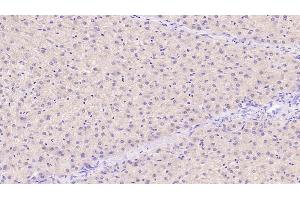 Detection of TIMP1 in Human Liver Tissue using Monoclonal Antibody to Tissue Inhibitors Of Metalloproteinase 1 (TIMP1) (TIMP1 抗体  (AA 25-207))