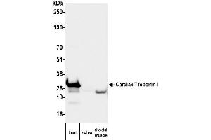 Western Blotting (WB) image for anti-Cardiac Troponin I (TNNI3) antibody (ABIN7795608)