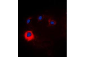 Immunofluorescent analysis of NOTCH1 staining in HeLa cells. (Notch1 抗体  (Center))
