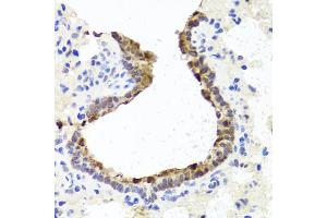 Immunohistochemistry of paraffin-embedded rat lung using TOPBP1 antibody. (TOPBP1 抗体)