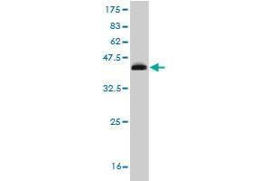 Western Blot detection against Immunogen (35. (RORB 抗体  (AA 136-224))