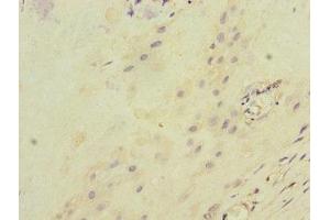 Immunohistochemistry of paraffin-embedded human placenta tissue using ABIN7156500 at dilution of 1:100 (ITGB8 抗体  (AA 43-320))