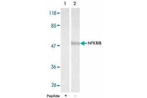 Western blot analysis of extracts from 293 cells using NFKBIB polyclonal antibody . (NFKBIB 抗体)