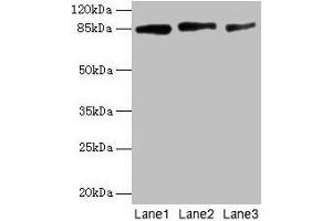 Western Blot All lanes: PLOD2 antibody at 12 μg/mL Lane 1: U87 whole cell lysate Lane 2: U251 whole cell lysate Lane 3: 293T whole cell lysate Secondary Goat polyclonal to rabbit IgG at 1/10000 dilution Predicted band size: 85, 88, 50 kDa Observed band size: 85 kDa