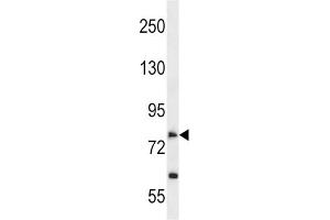 Western Blotting (WB) image for anti-Solute Carrier Family 28 (Sodium-Coupled Nucleoside Transporter), Member 2 (SLC28A2) antibody (ABIN2998577) (SLC28A2 抗体)