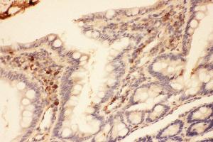 Anti-MMP7 Picoband antibody,  IHC(P): Rat intestines Tissue (MMP7 抗体  (AA 95-264))