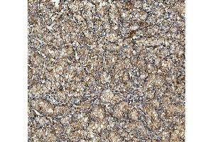 IHC analysis of NSF using anti-NSF antibody (ABIN7601630). (NSF 抗体  (AA 4-636))