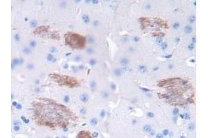 Detection of TNFa in Mouse Cerebrum Tissue using Monoclonal Antibody to Tumor Necrosis Factor Alpha (TNFa)
