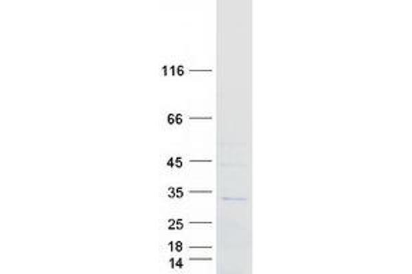 RAB40A Protein (Myc-DYKDDDDK Tag)