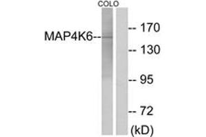 Western blot analysis of extracts from COLO cells, using MAP4K6 Antibody. (MAP4K6 抗体  (AA 401-450))