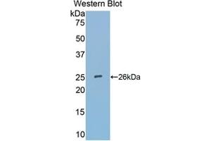 Western blot analysis of the recombinant protein. (SFRP4 抗体  (AA 25-222))