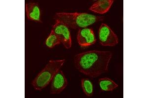 IF analysis of VPRBP/DCAF1 using anti-VPRBP/DCAF1 antibody (ABIN7602005). (DDB1 and CUL4-Associated Factor 1 (DCAF1) (AA 540-861) 抗体)