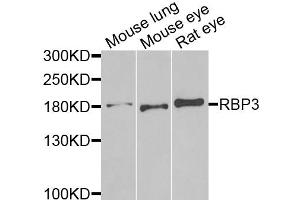 Western blot analysis of extracts of various cell lines, using RBP3 antibody. (RBP3 抗体)
