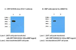 Transfected and non-transfected 293T cell lysates were resolved by SDS-PAGE, transferred to nitrocellulose membrane and probed with anti- ORF73/HHV8 (1:1,000) and anti-MBP (1:1,000). (HHV 8 (AA 122-329) 抗体)