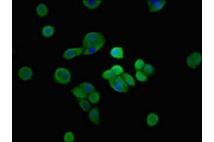 Immunofluorescent analysis of PC-3 cells using ABIN7169471 at dilution of 1:100 and Alexa Fluor 488-congugated AffiniPure Goat Anti-Rabbit IgG(H+L) (SH3TC2 抗体  (AA 188-427))