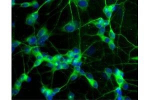 Immunofluorescent staining of differentiated SH-SY5Y cells. (MAP2 抗体  (AA 19-219))