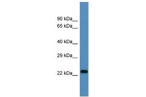 Host:  Rabbit  Target Name:  U2AF1L4  Sample Type:  HepG2 Whole cell lysates  Antibody Dilution:  1.